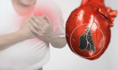 Các yếu tố nguy cơ thường gặp của bệnh tim mạch