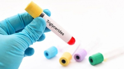 Triglyceride trong máu cao nói lên điều gì?