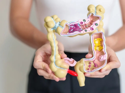 Những điều cần biết về bệnh viêm ruột thừa