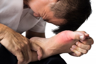 9 giả thiết và sự thật về bệnh gút