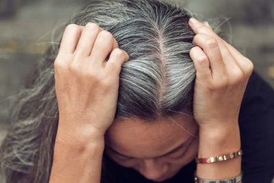 Nguyên nhân khiến tóc bạc sớm