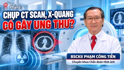 Phần 1: CHỤP CT SCAN, X-QUANG CÓ GÂY UNG THƯ?