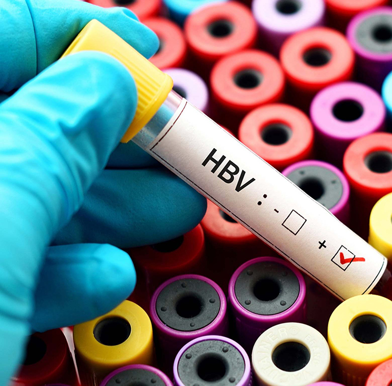 H2 Xét nghiệm HBV