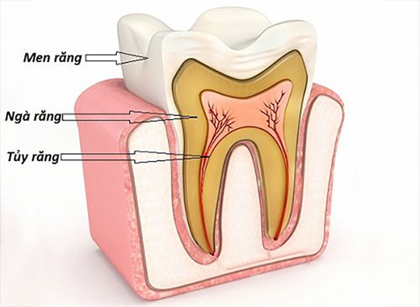 răng e buot minhanh 2