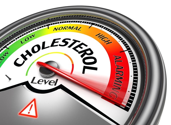 Nồng độ cholesterol cao ảnh hưởng xấu đến sức khỏe