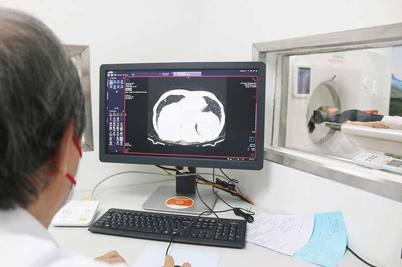 ct scan 1