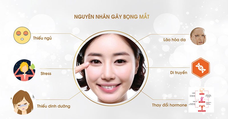nguyen nhan gay bong mat