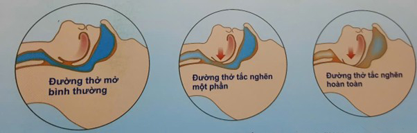 ád