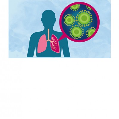 Cẩn trọng với bệnh viêm phổi ( phần 2)
