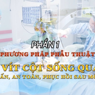Phần 1: Phương pháp phẫu thuật bắt vít cột sống...