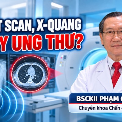 Phần 1: CHỤP CT SCAN, X-QUANG CÓ GÂY UNG THƯ?