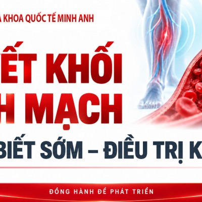 🩺 THUYÊN TẮC HUYẾT KHỐI TĨNH MẠCH – ĐỪNG BỎ QUA...
