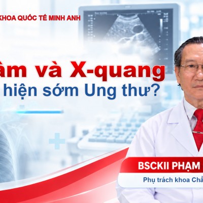 🔎 SIÊU ÂM VÀ X-QUANG CÓ PHÁT HIỆN SỚM UNG THƯ?